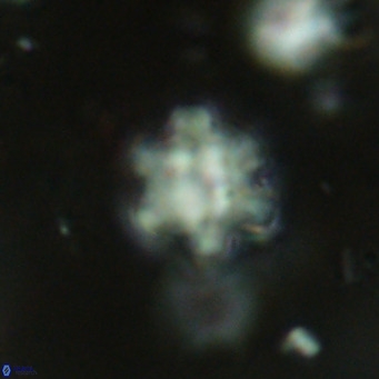 Discoaster catillomicros VR 18701