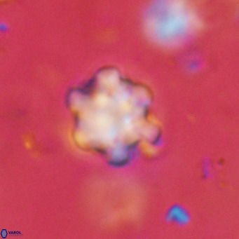 Discoaster catillomicros VR 18702