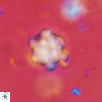 Discoaster catillomicros VR 18702
