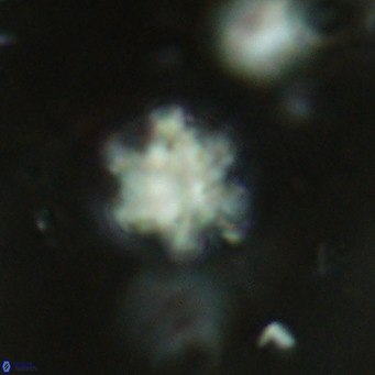 Discoaster catillomicros VR 18703