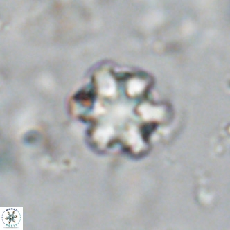 Discoaster catillomicros VR 18704