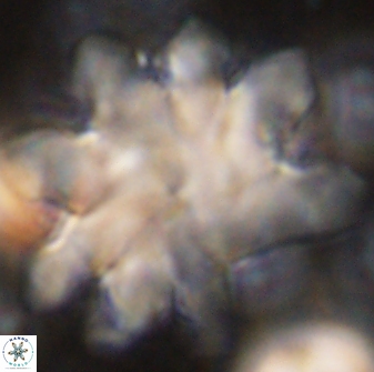 Discoaster cf mediosus 54396