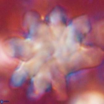 Discoaster cf mediosus 54397