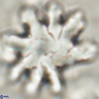 Discoaster cf mediosus 54398