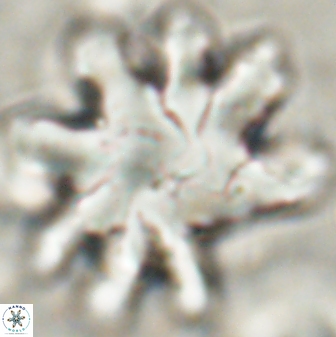 Discoaster cf mediosus 54398