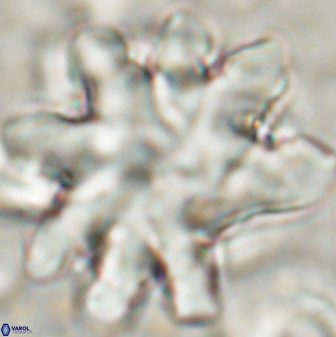 Discoaster cf mediosus 54399