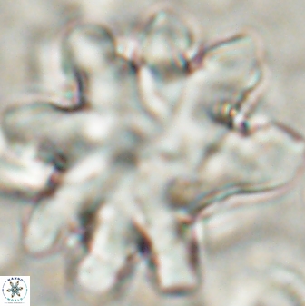 Discoaster cf mediosus 54399