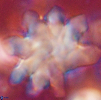Discoaster cf mediosus 54404