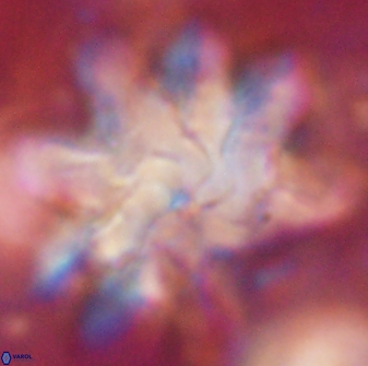 Discoaster cf mediosus 54405