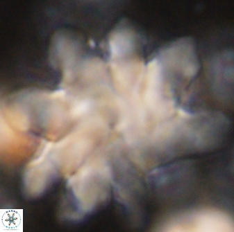 Discoaster cf mediosus 54406