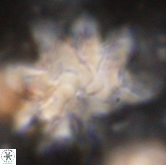 Discoaster cf mediosus 54407