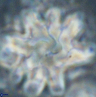 Discoaster cf mediosus 54400