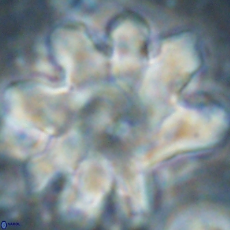 Discoaster cf mediosus 54401