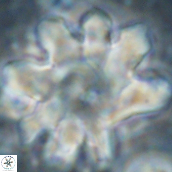 Discoaster cf mediosus 54401