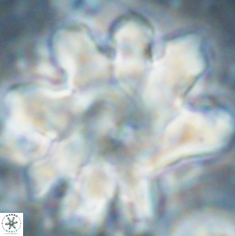 Discoaster cf mediosus 54402
