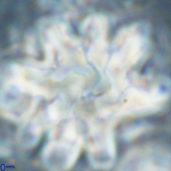 Discoaster cf mediosus 54403