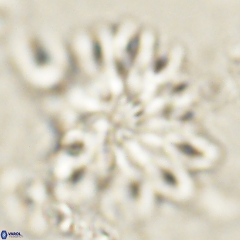Discoaster cf splendidus 61017