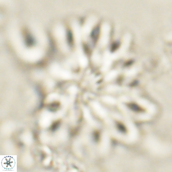 Discoaster cf splendidus 61017