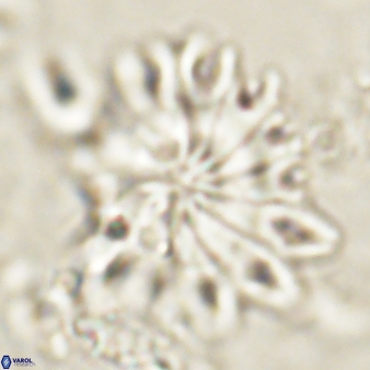 Discoaster cf splendidus 61019