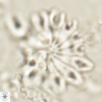 Discoaster cf splendidus 61019