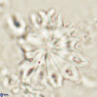 Discoaster cf splendidus 61020