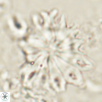 Discoaster cf splendidus 61020