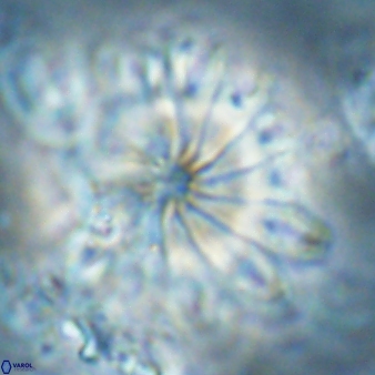 Discoaster cf splendidus 61023