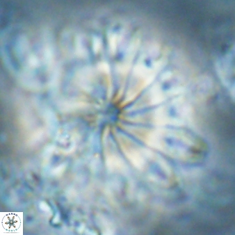 Discoaster cf splendidus 61023