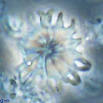 Discoaster cf splendidus 61025
