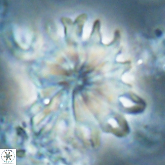 Discoaster cf splendidus 61025