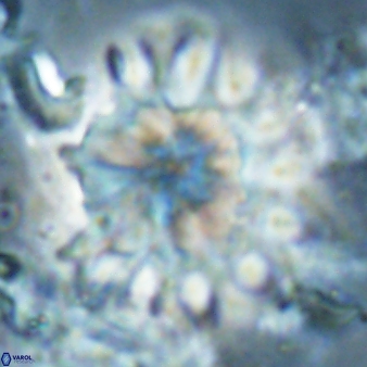 Discoaster cf splendidus 61026
