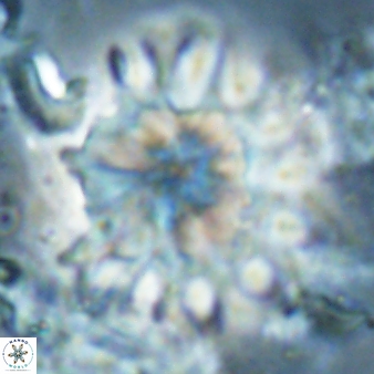 Discoaster cf splendidus 61026