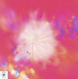 Discoaster cf splendidus 61028