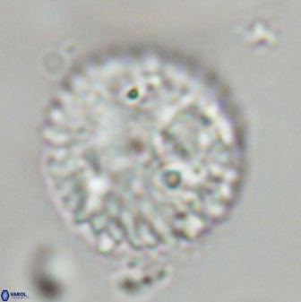 Discoaster delicatus 43742
