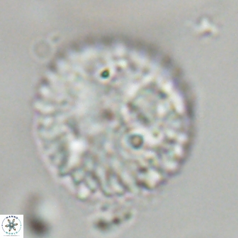 Discoaster delicatus 43742