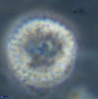 Discoaster delicatus 43743