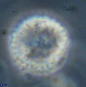 Discoaster delicatus 43744