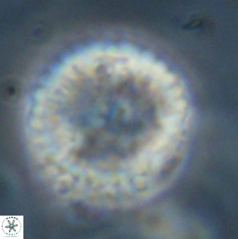 Discoaster delicatus 43744