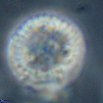 Discoaster delicatus 43745