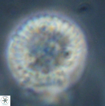 Discoaster delicatus 43745