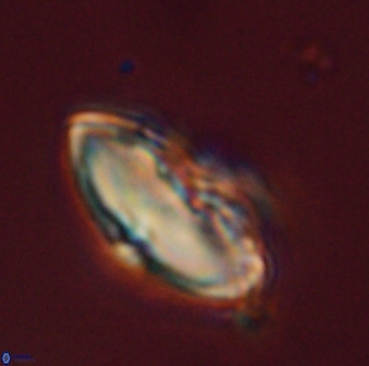 Discoaster delicatus 43739