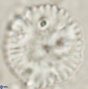 Discoaster delicatus 54353