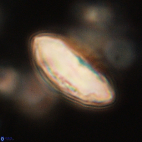 Discoaster delicatus 69954