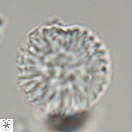 Discoaster delicatus 69938