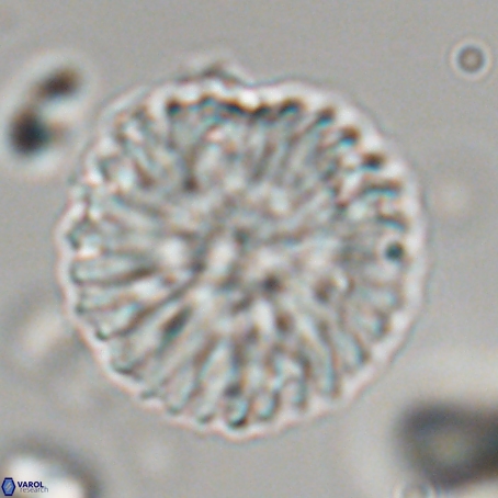 Discoaster delicatus 69939