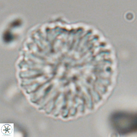 Discoaster delicatus 69939