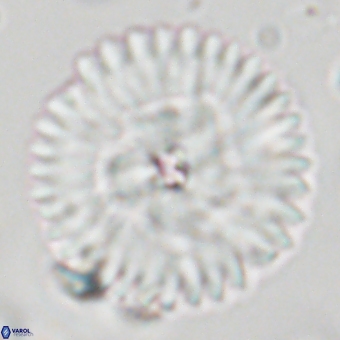 Discoaster delicatus 70851