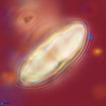 Discoaster delicatus 70857