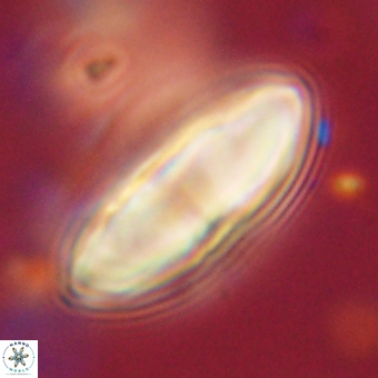 Discoaster delicatus 70857