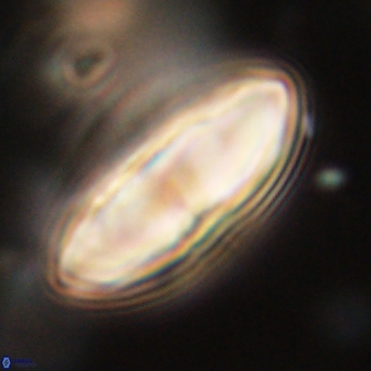 Discoaster delicatus 70858